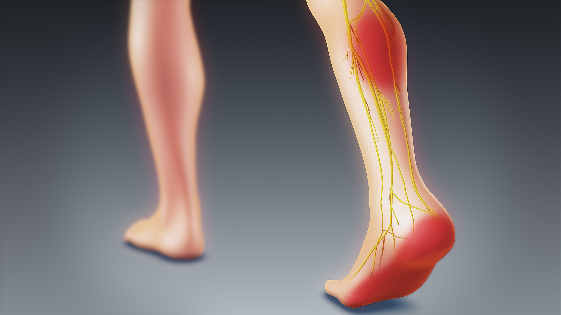 Pain Going Down Your Leg? How to Know If It Is Sciatica
