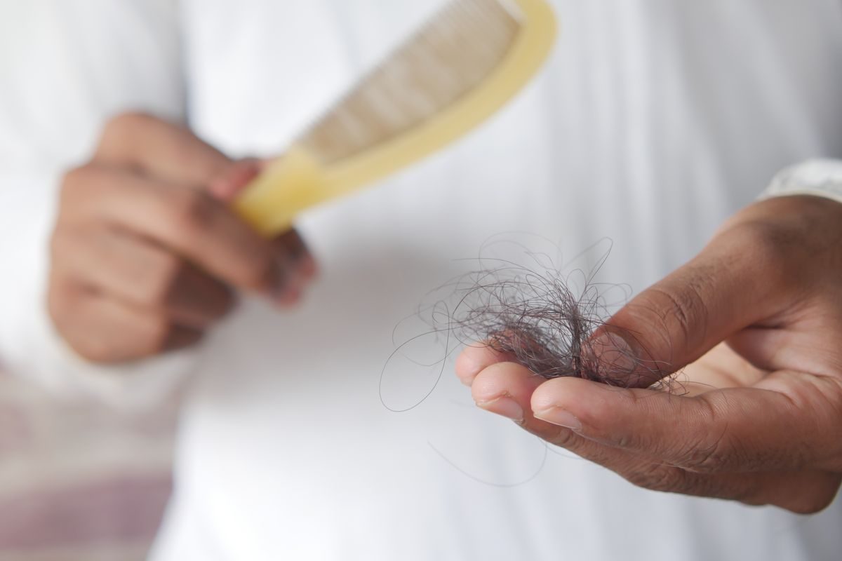 Hair Fall Ayurvedic treatment at Dr. Abrol Ayurveda, Amritsar