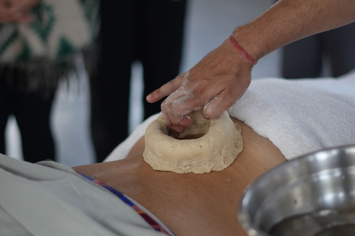 Traditional Kati Basti therapy with a ring of dough holding warm medicated oil on the lower back